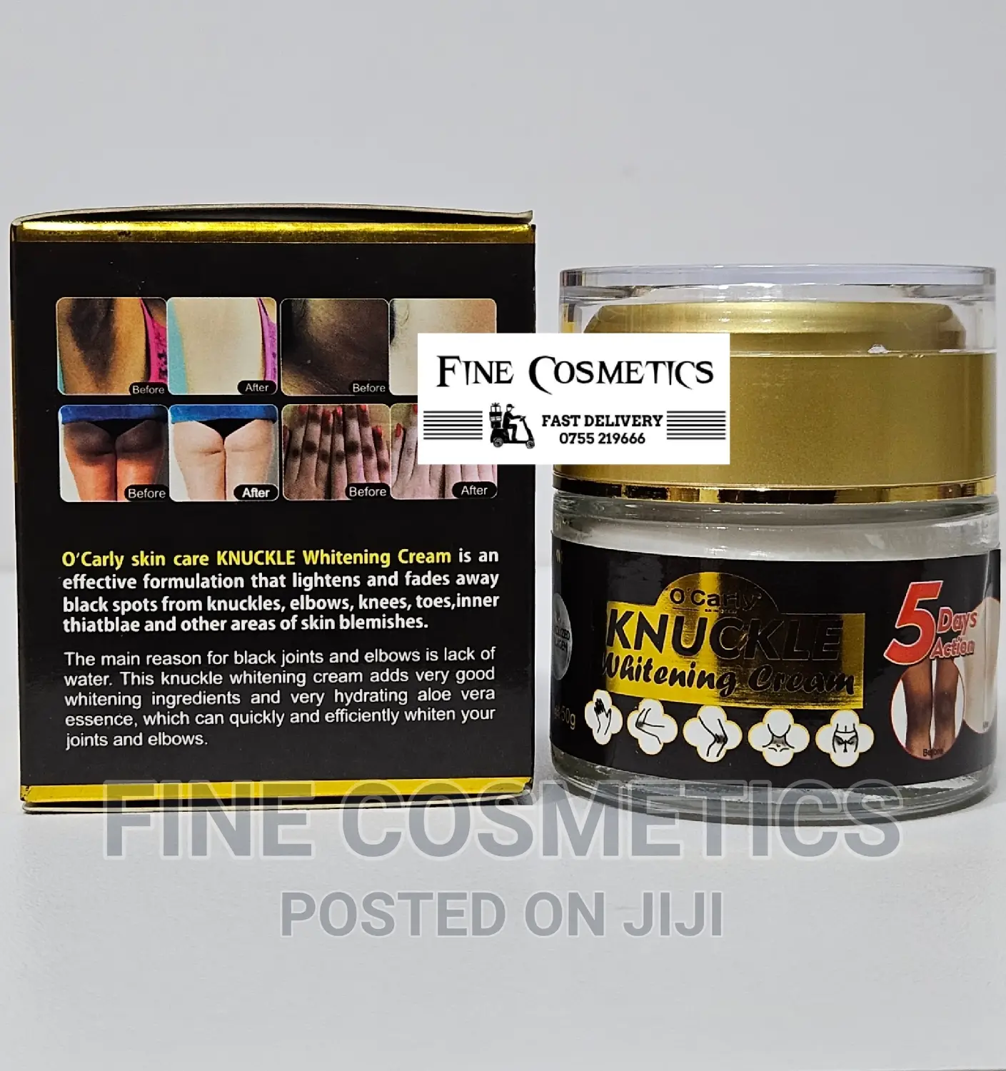 O'Carly Skin Care 5days Dark Knuckle Remover Whitening Cream