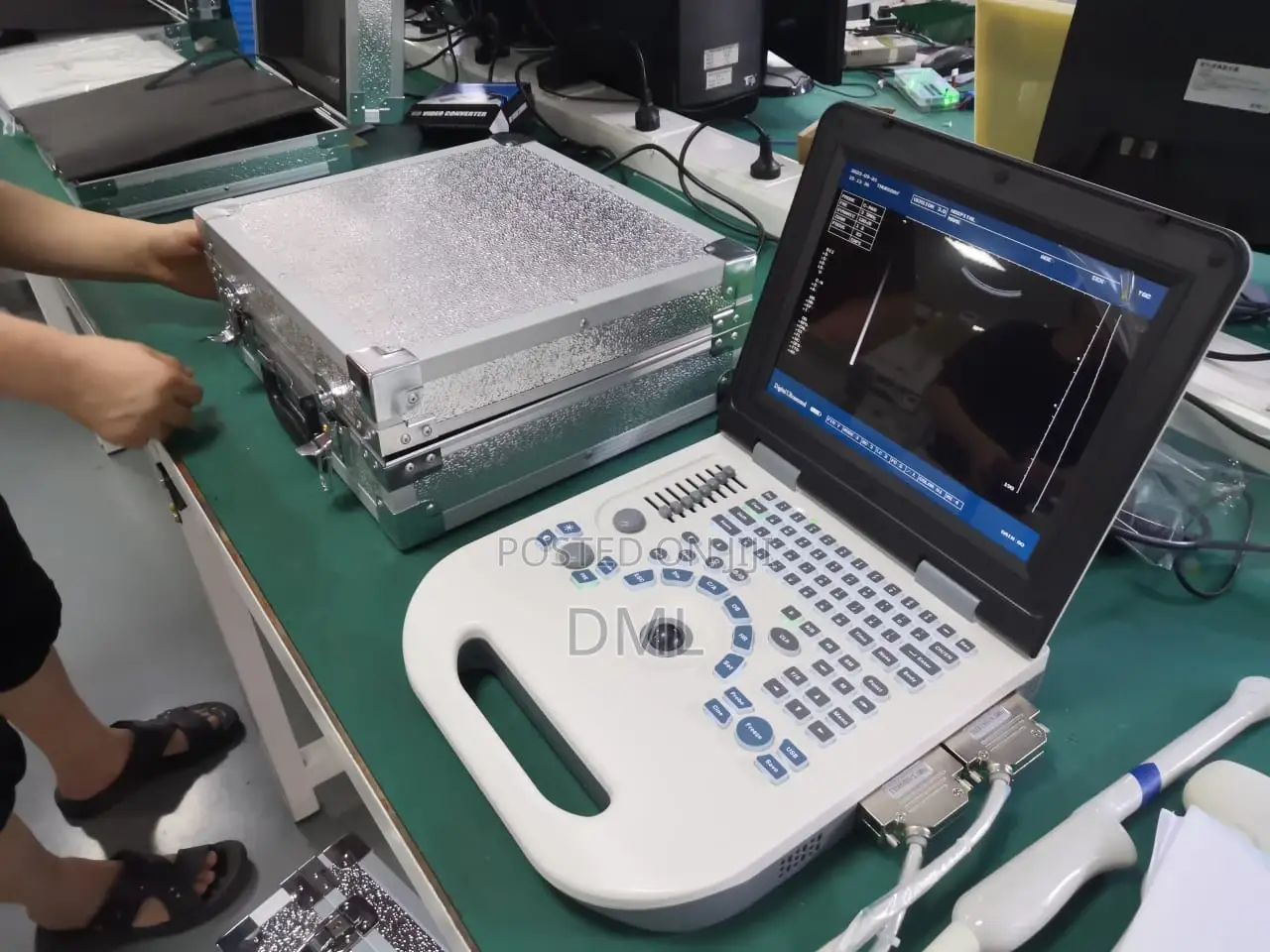 Portable Ultrasound Scan (Back Up Battery)