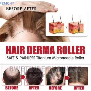 Roller for Hair Loss, Beard Growth, Hair Scalp Massager