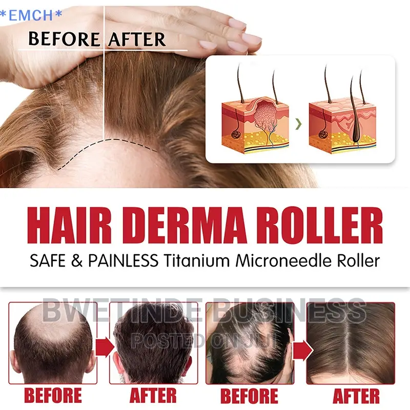Roller for Hair Loss, Beard Growth, Hair Scalp Massager