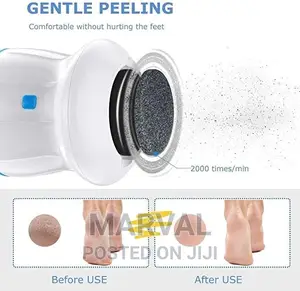 Cellus Remover (Foot Smoothener)