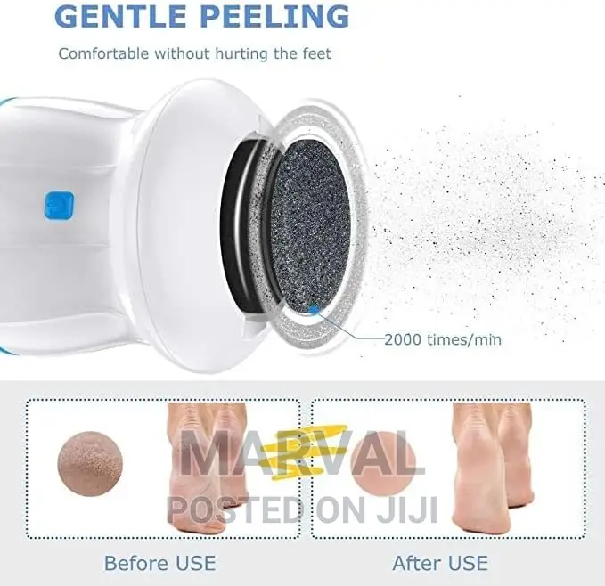 Cellus Remover (Foot Smoothener)