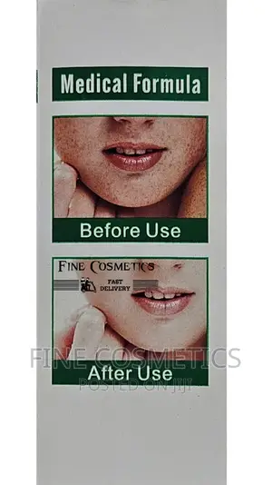 Medical Formula Anti-Freckle Whitening Facial Serum 30ml