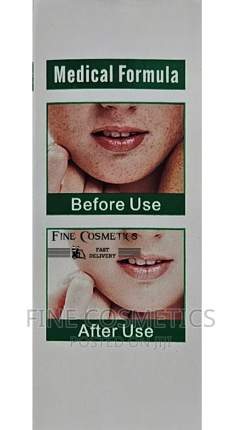 Medical Formula Anti-Freckle Whitening Facial Serum 30ml
