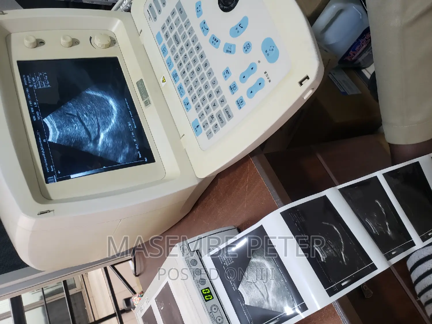 Dp 1100 Plus , Mindray Ultrasound Scan