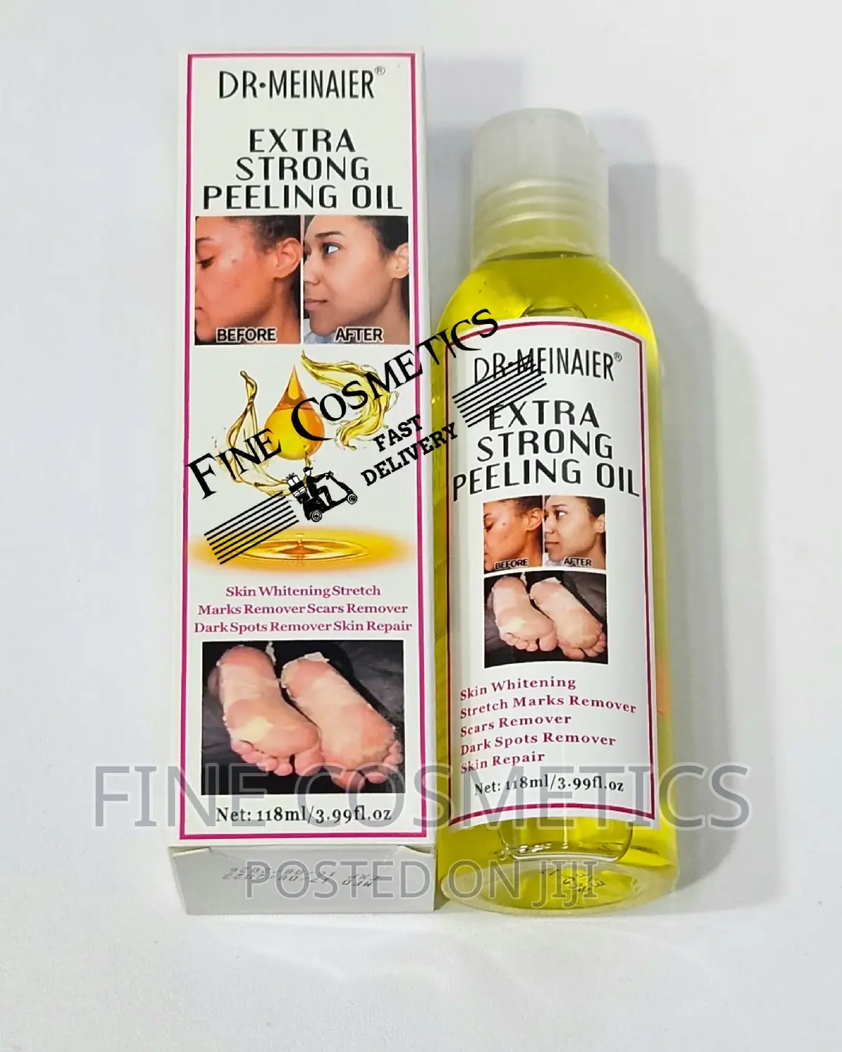 Extra Strong Skin Peeling Oil for New Fresh Skin Dr Meinaier