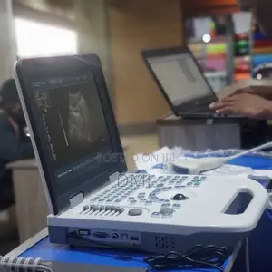 Portable Ultrasound Scan (Back Up Battery)