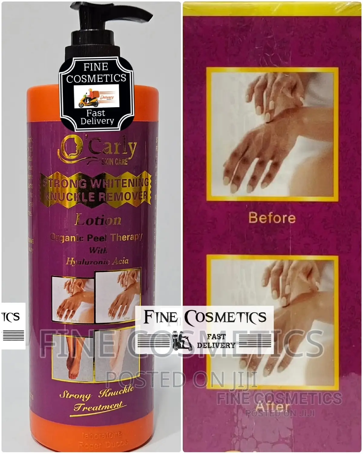 O'carly Strong Whitening Knuckle Remover Lotion Peel Off