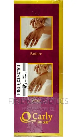 O'carly Strong Whitening Knuckle Remover Lotion Peel Off