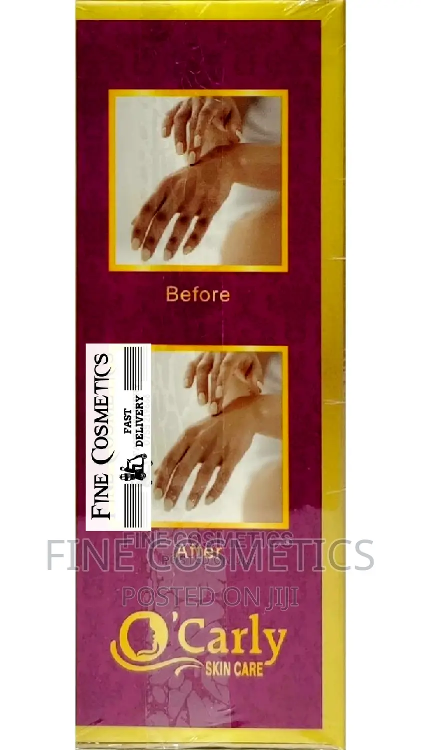 O'carly Strong Whitening Knuckle Remover Lotion Peel Off