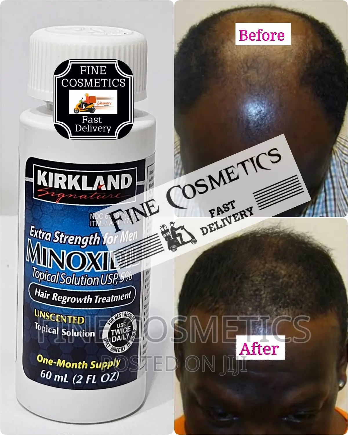 1PC KIRKLAND Men's Hair Regrowth Booster Nd Beard Stimulator