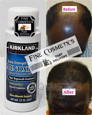 1PC KIRKLAND Men's Hair Regrowth Booster Nd Beard Stimulator