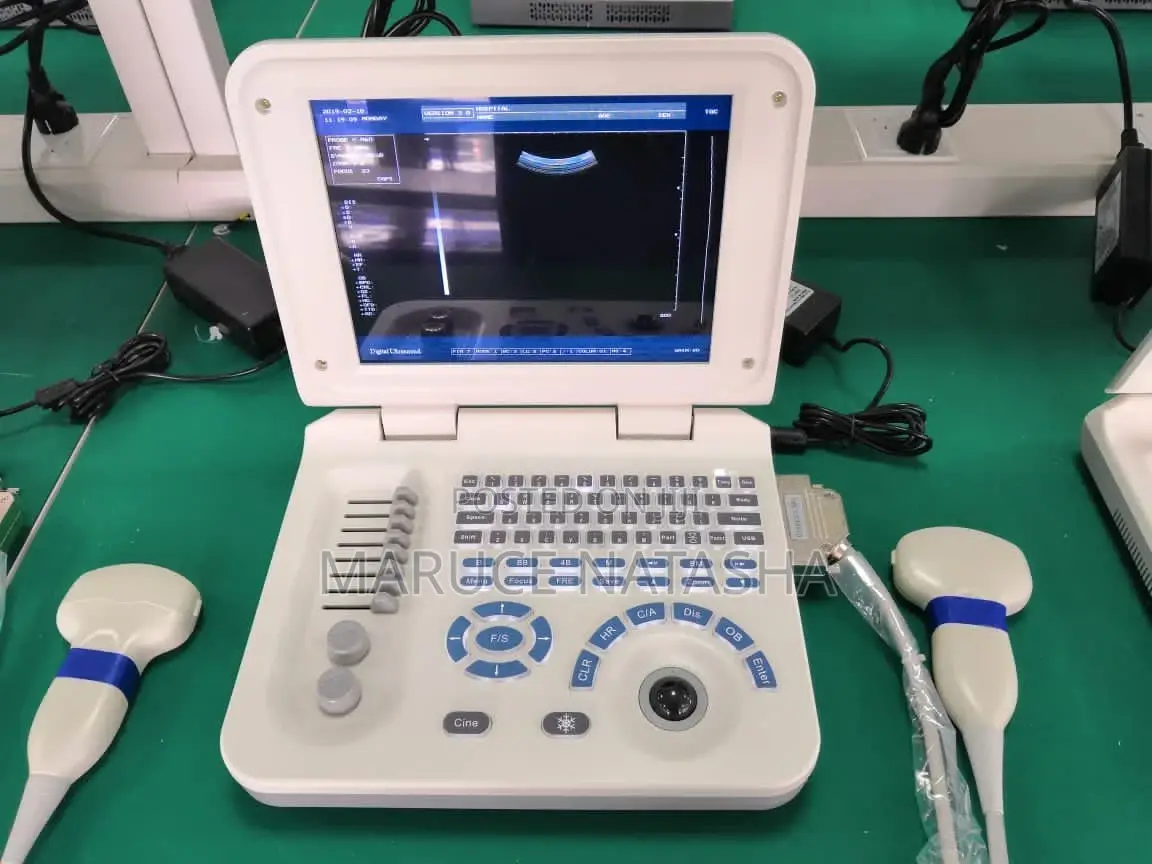 Brand New Laptop Size Ultrasound With a Printer and It’S Bag