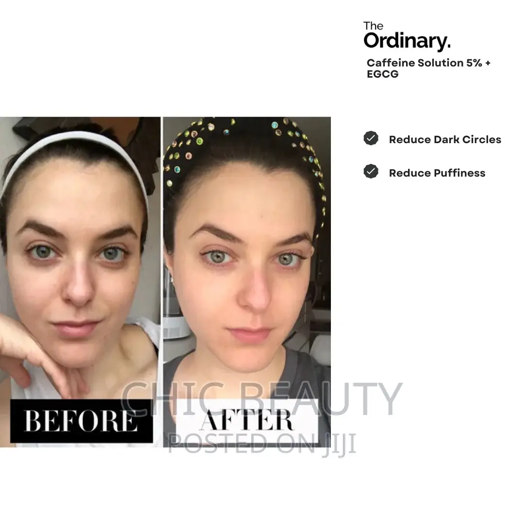 The Ordinary Caffeine Eye Serum Solution, 5%+EGCG Eye Serum