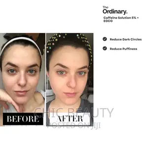 The Ordinary Caffeine Eye Serum Solution, 5%+EGCG Eye Serum