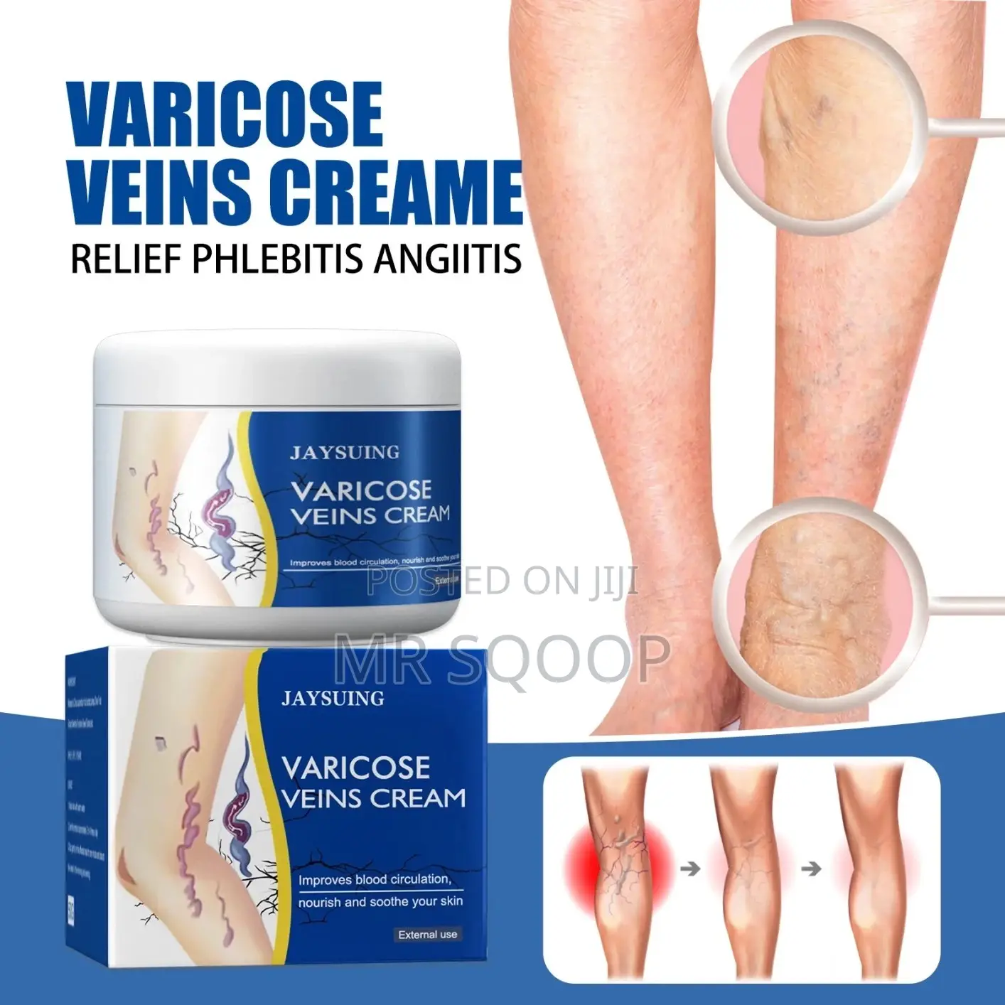 Varicose Veins Cream For Leg Pain Swelling 50g