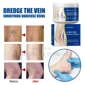 2pcs Jaysuing Varicose Veins Leg Care Cream for Skin Massage