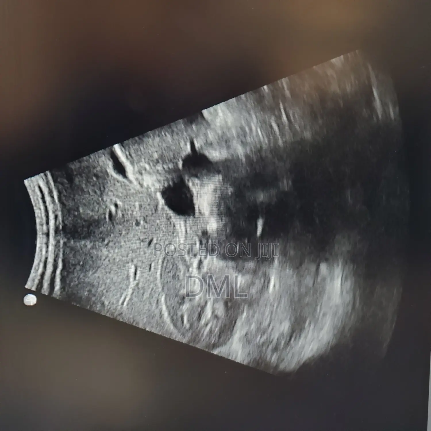 Ultrasound Machine (Color Doppler)