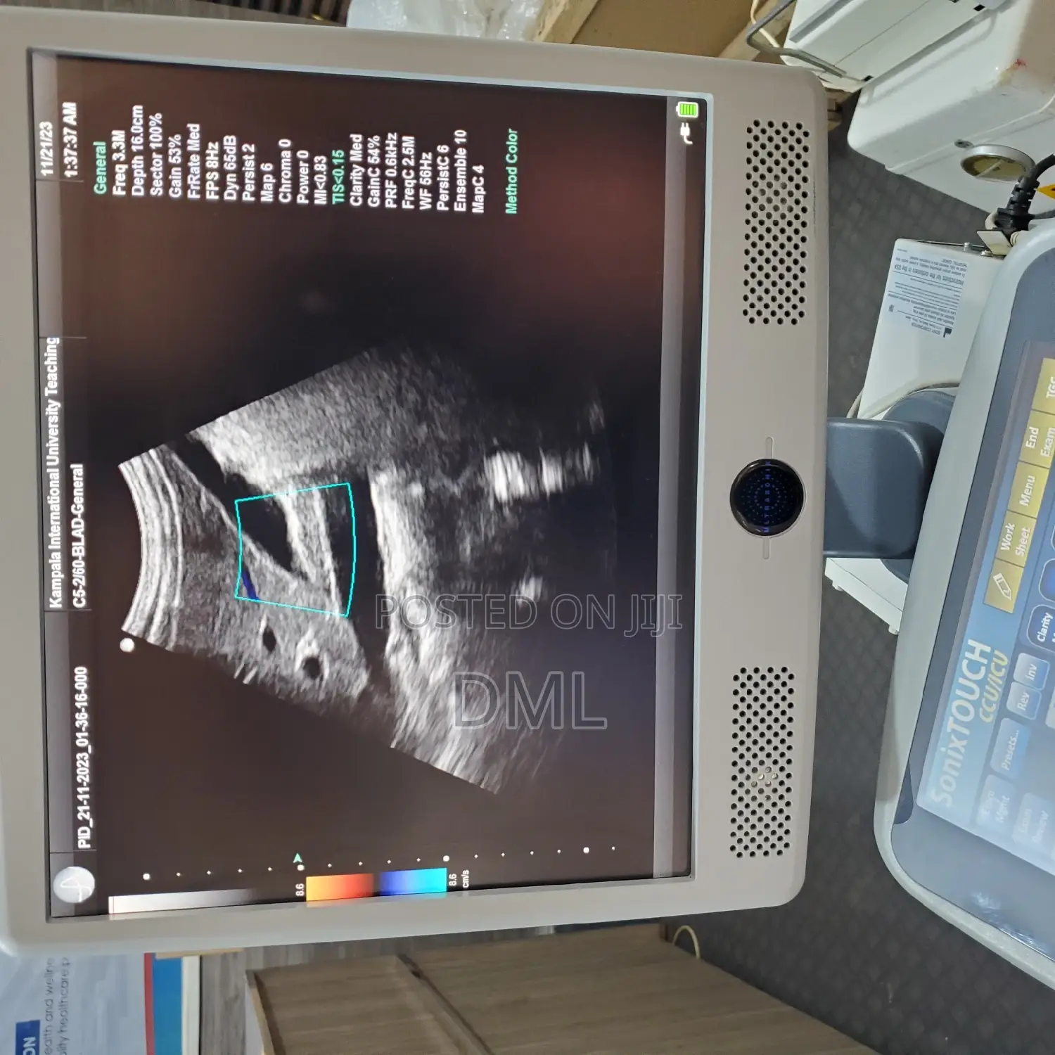 Ultrasound Machine (Color Doppler)
