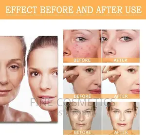 The Ordinary Glycolic Acid 7% Toning Solution Gentle Toner
