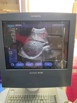 Refurbished High End Ultrasound Scan(Siemens Acuson X150)