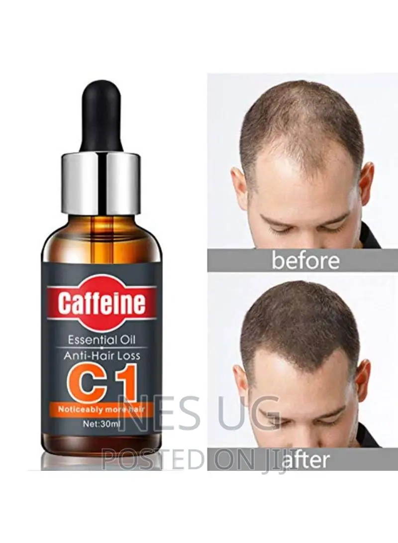 Caffeine C1 Anti Hair Loss Essential Oil 30ml