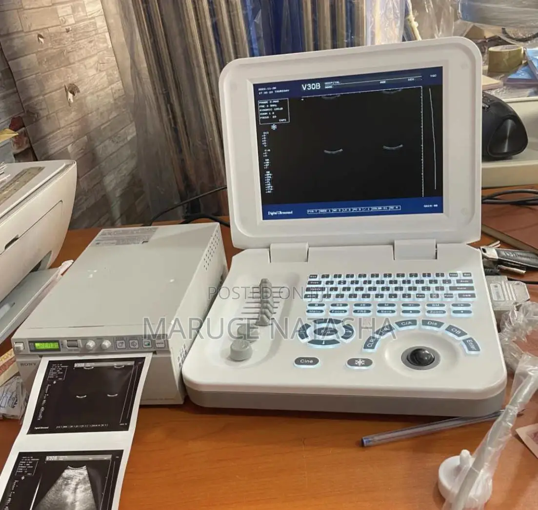 High Quality Laptop Size Ultrasound Scan
