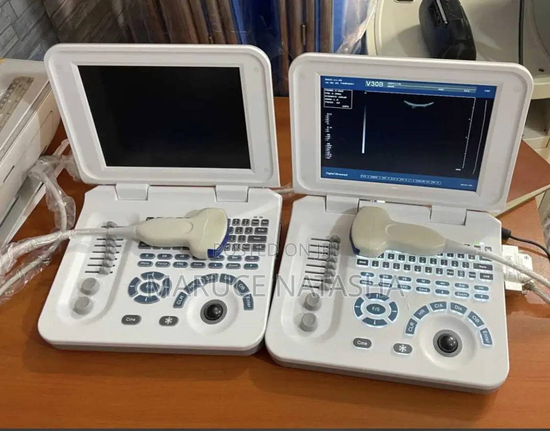 High Quality Laptop Size Ultrasound Scan