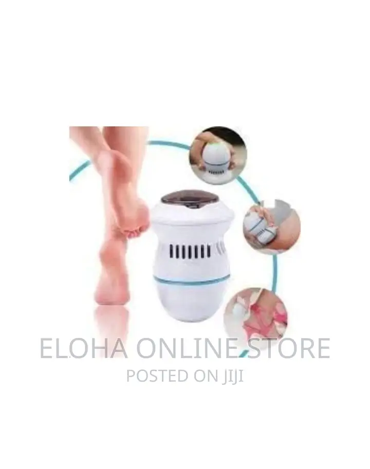 Callus Remover