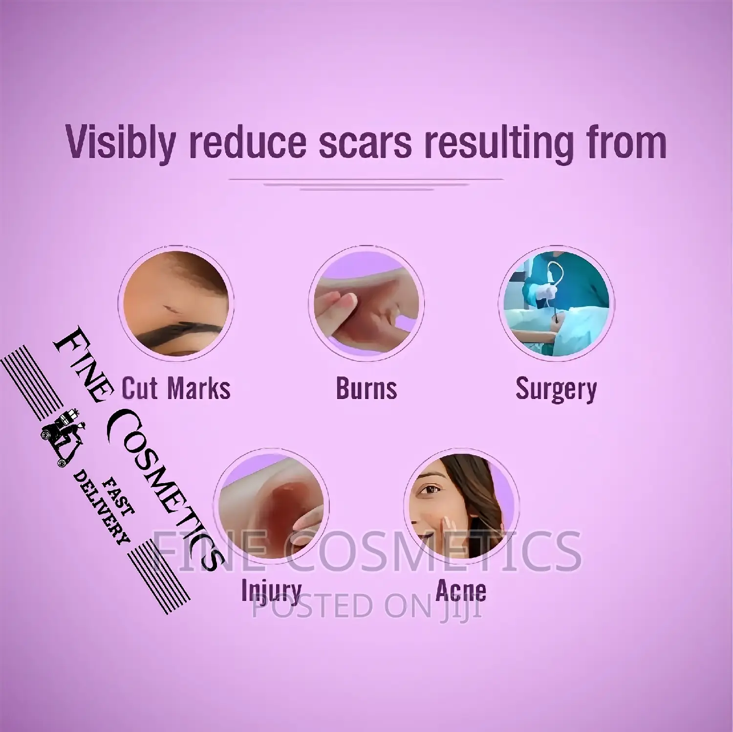 NO SCAR CREAM |Doctors Recommended Scar Remover + Darkcircle