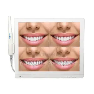 Intra Oral Camera With the Monitor