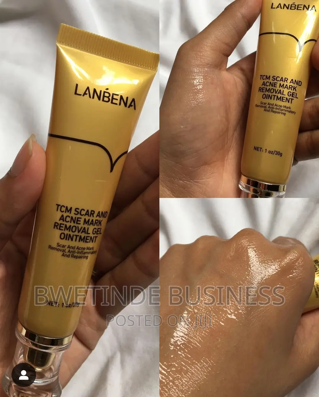 Scar Removal Cream for Old Scars and Gel Removal