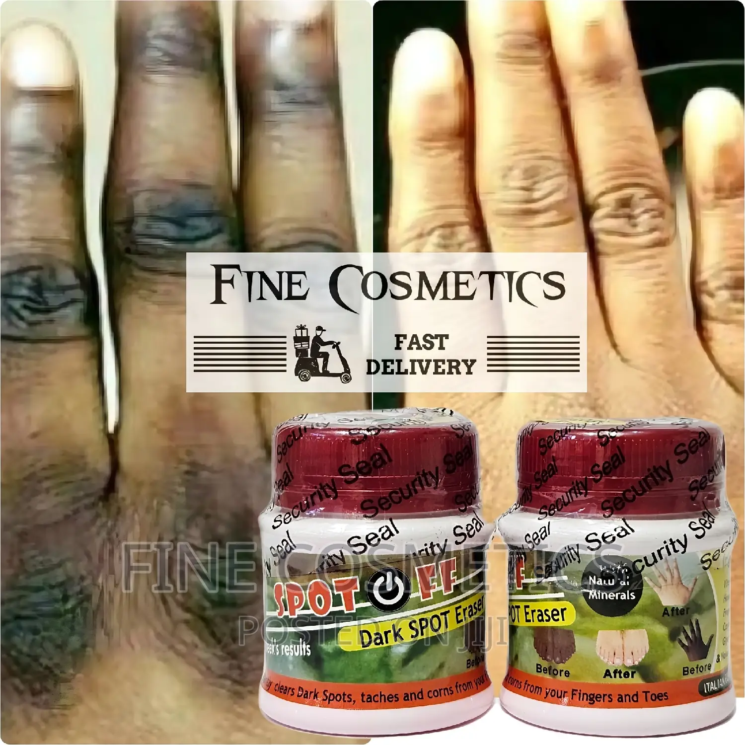 Spot Off |Dark Knuckle Remover Cream Care for Feet and Knees