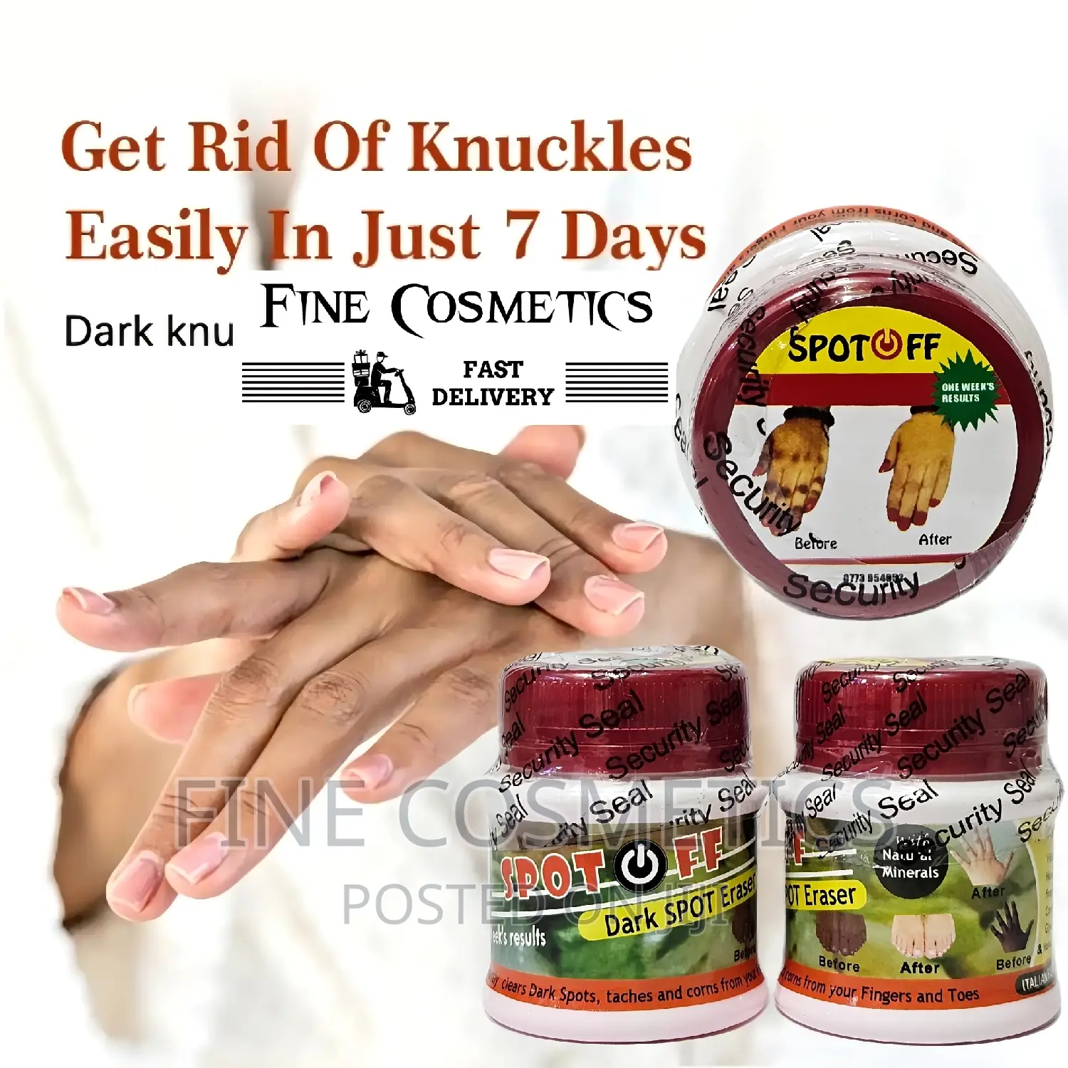 Spot Off |Dark Knuckle Remover Cream Care for Feet and Knees