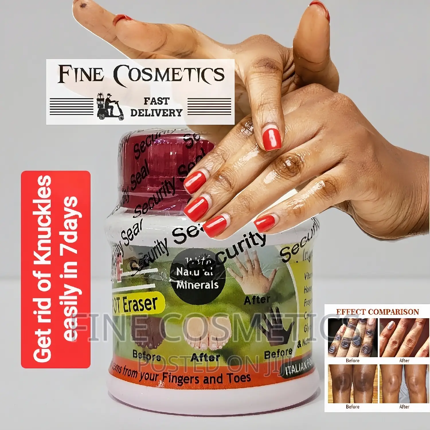 Spot Off |Dark Knuckle Remover Cream Care for Feet and Knees