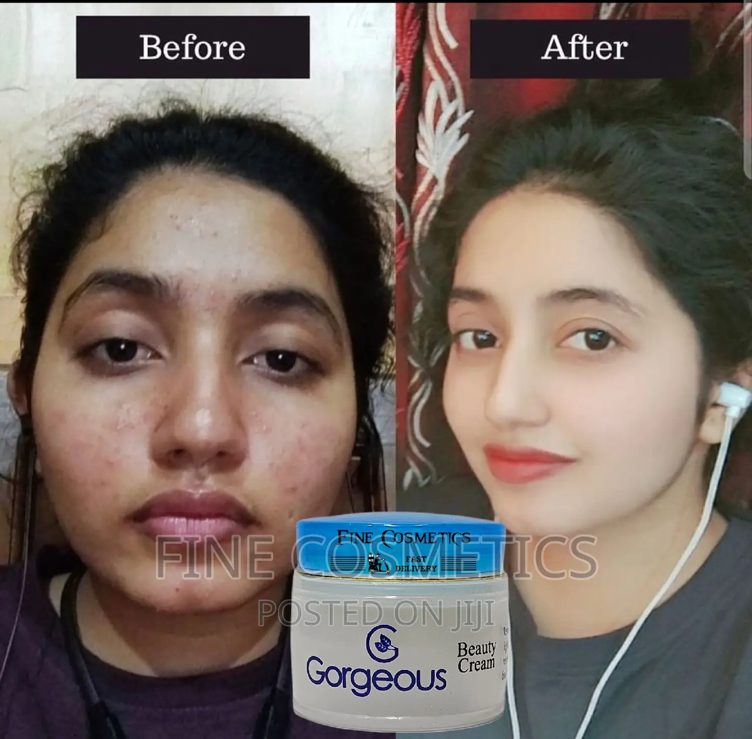 Gorgeous Beauty Cream for Spots and Dark Circles Under Eyes