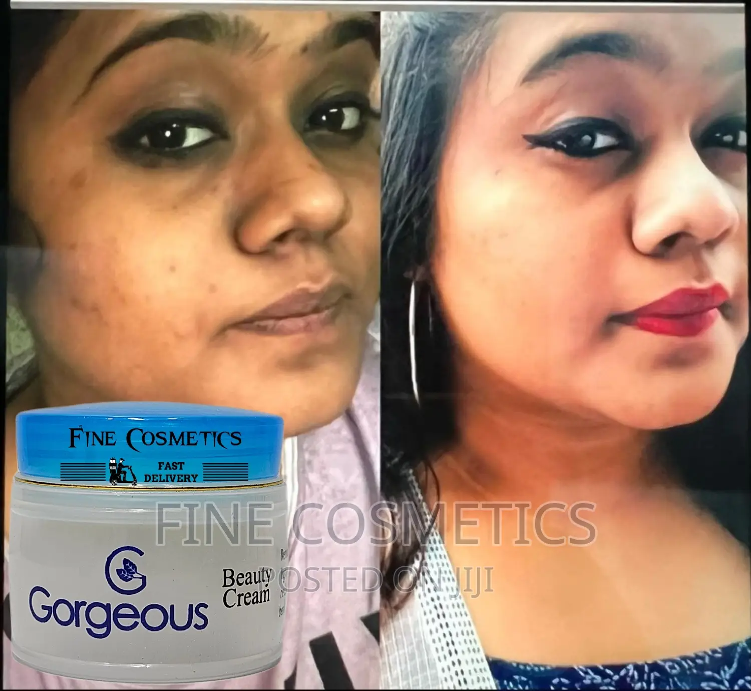Gorgeous Beauty Cream for Spots and Dark Circles Under Eyes