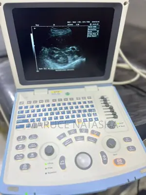 Refurbished Mindray Dp 10