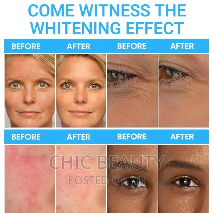 Hyaluronic ACID Anti-Aging Moisturizing 100ml