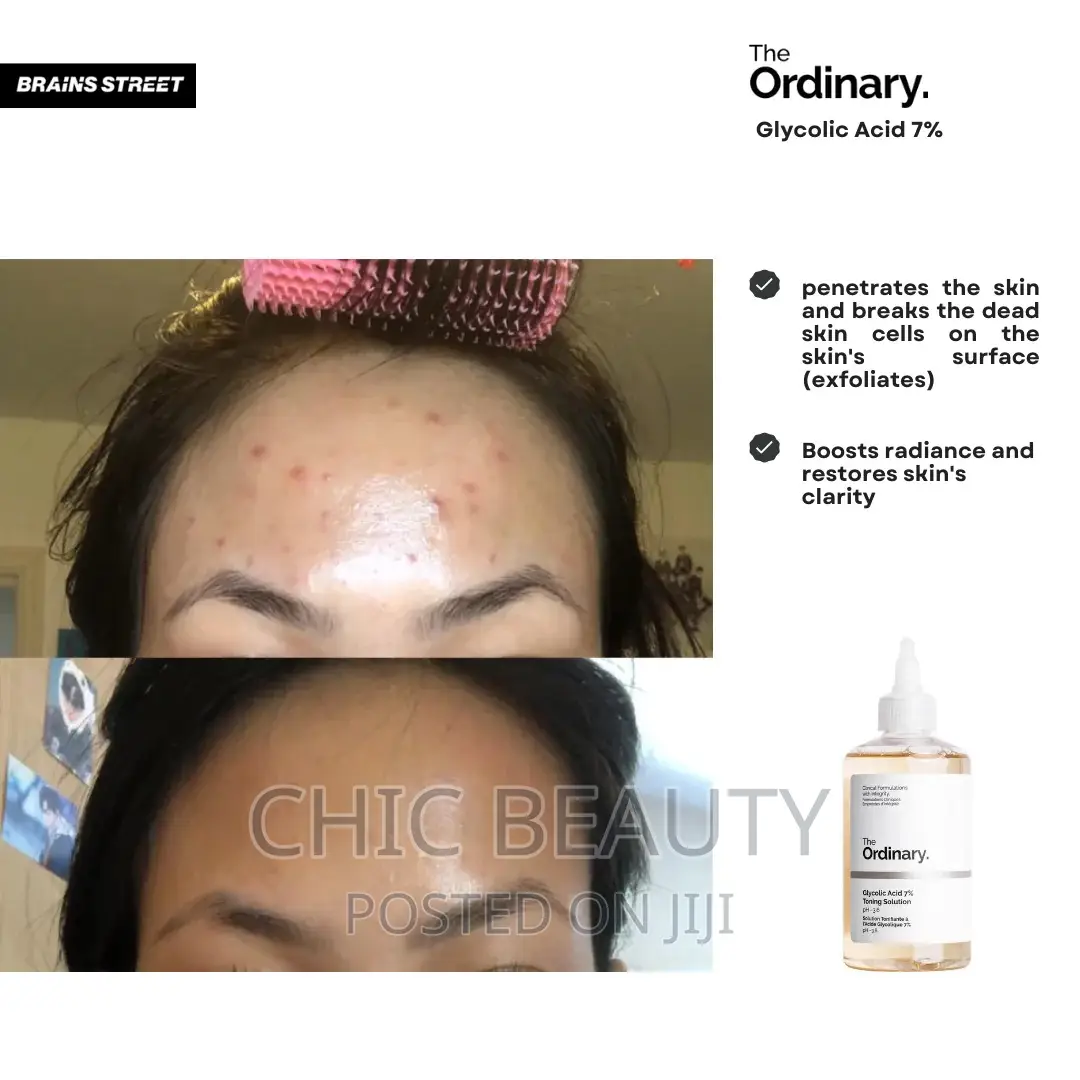 The Ordinary Glycolic Acid 7% Toning Solution 240ml