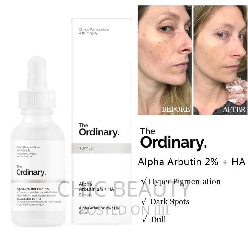 The Ordinary - Alpha Arbutin 2% HA Serum 30ml