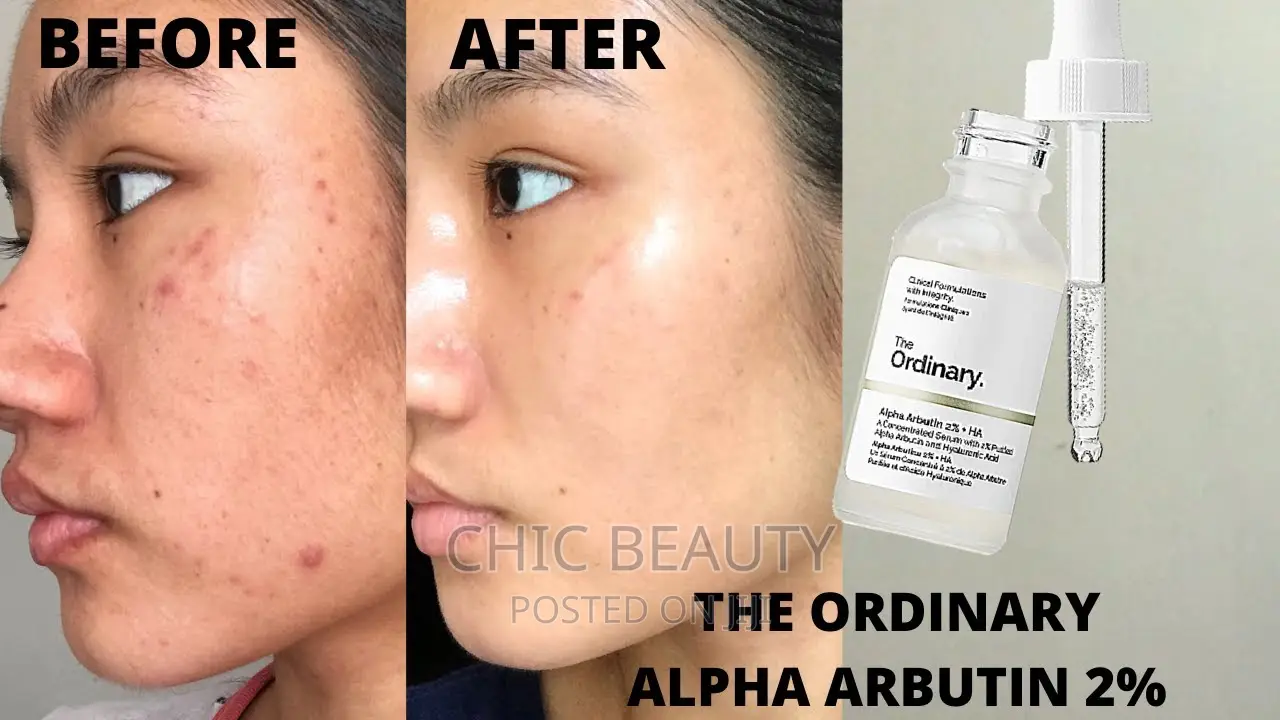 The Ordinary - Alpha Arbutin 2% HA Serum 30ml