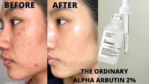 The Ordinary - Alpha Arbutin 2% HA Serum 30ml