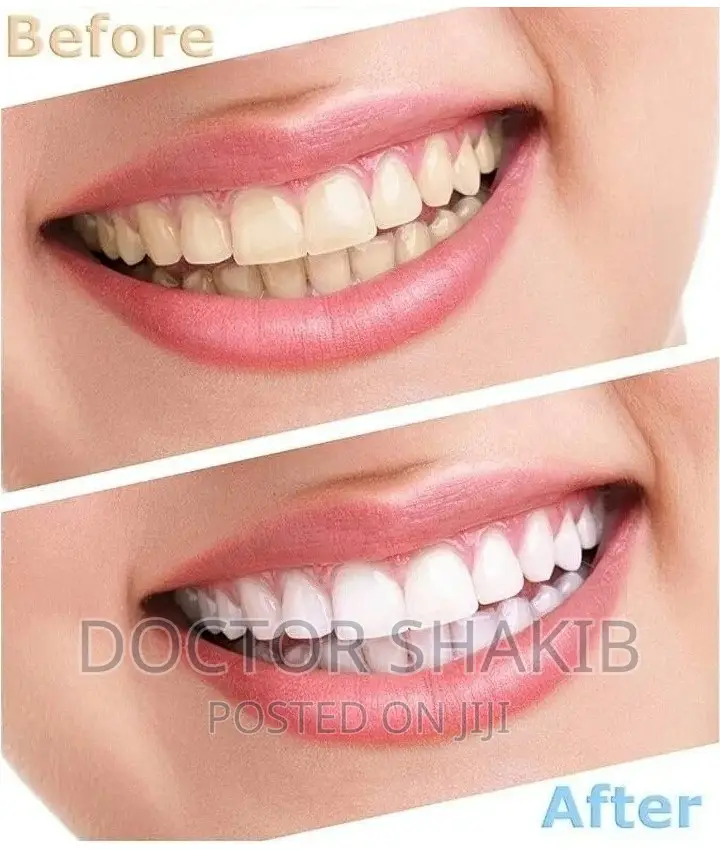New Dental White Light Tooth Whitener