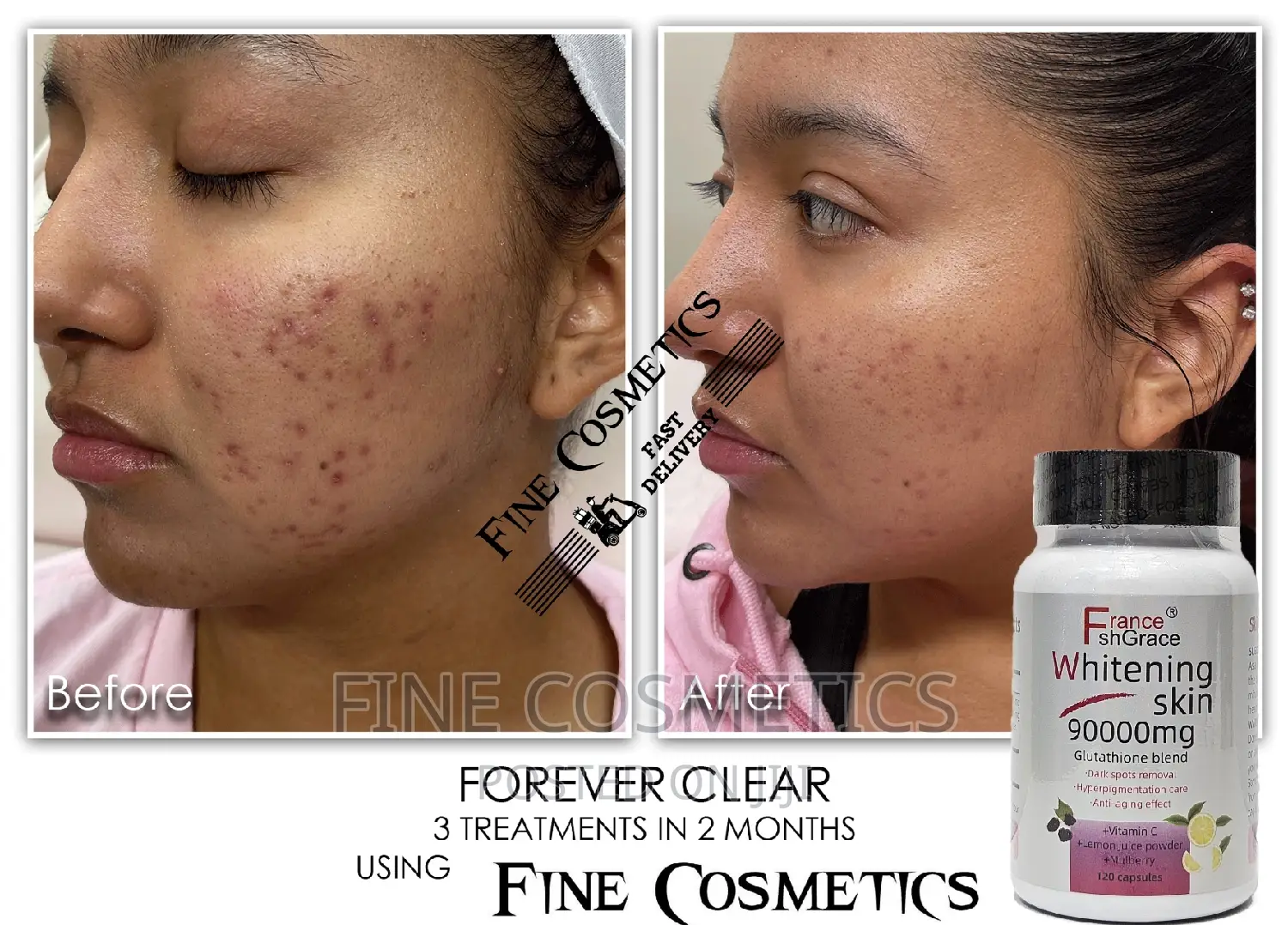 Effective Skin Whitening Glutathione Pills Wiz Vitamin C.120