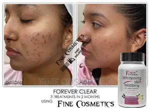 Effective Skin Whitening Glutathione Pills Wiz Vitamin C.120