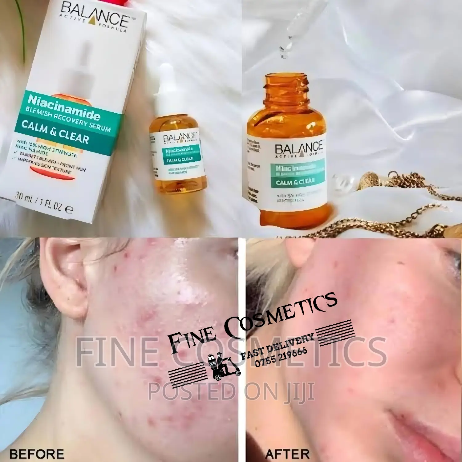 BALANCE Niacinamide Blemish Recovery Calm and Clear Serum.