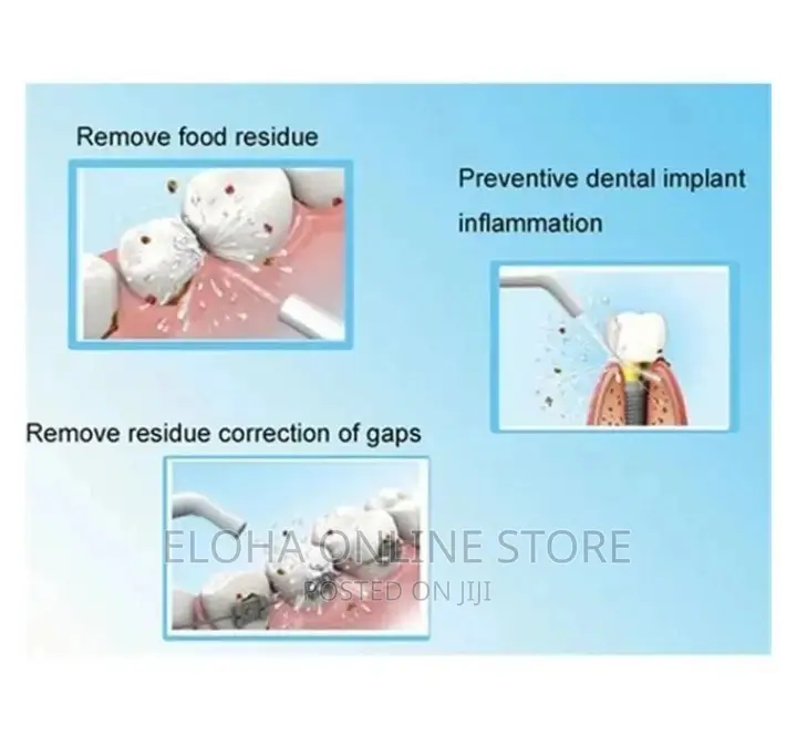 Sonic Teeth Callus Remover Tool