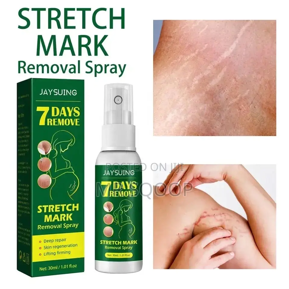 Jaysuing 7 Days Stretch Marks Removal Spray Postpartum