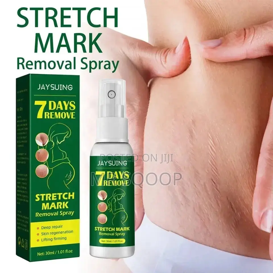 Jaysuing 7 Days Stretch Marks Removal Spray Postpartum